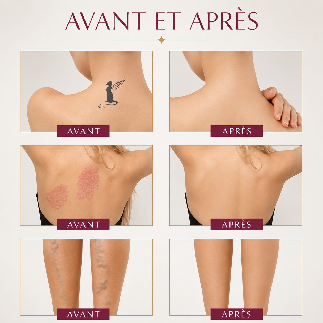 Phlorra — Correcteur Corporel