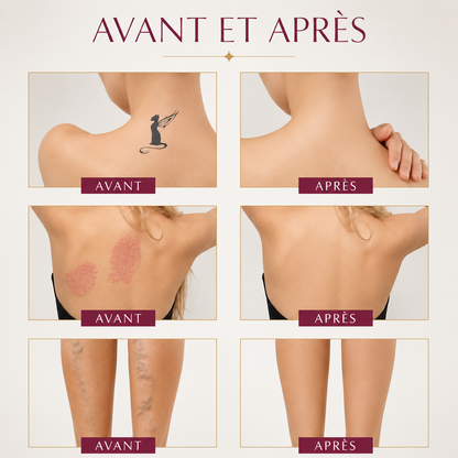 Phlorra — Correcteur Corporel