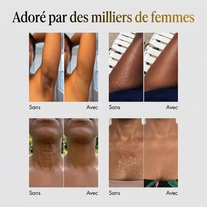 Phlorra™ Body Coverage Perfector à l'Huile de Nigelle